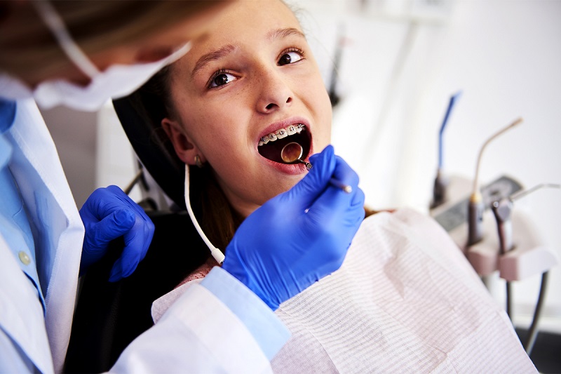 Leczenie ortodontyczne u dzieci – jakie są rodzaje aparatów na zęby?