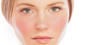 Dermokosmetyki na trądzik różowaty – jakie wybrać?